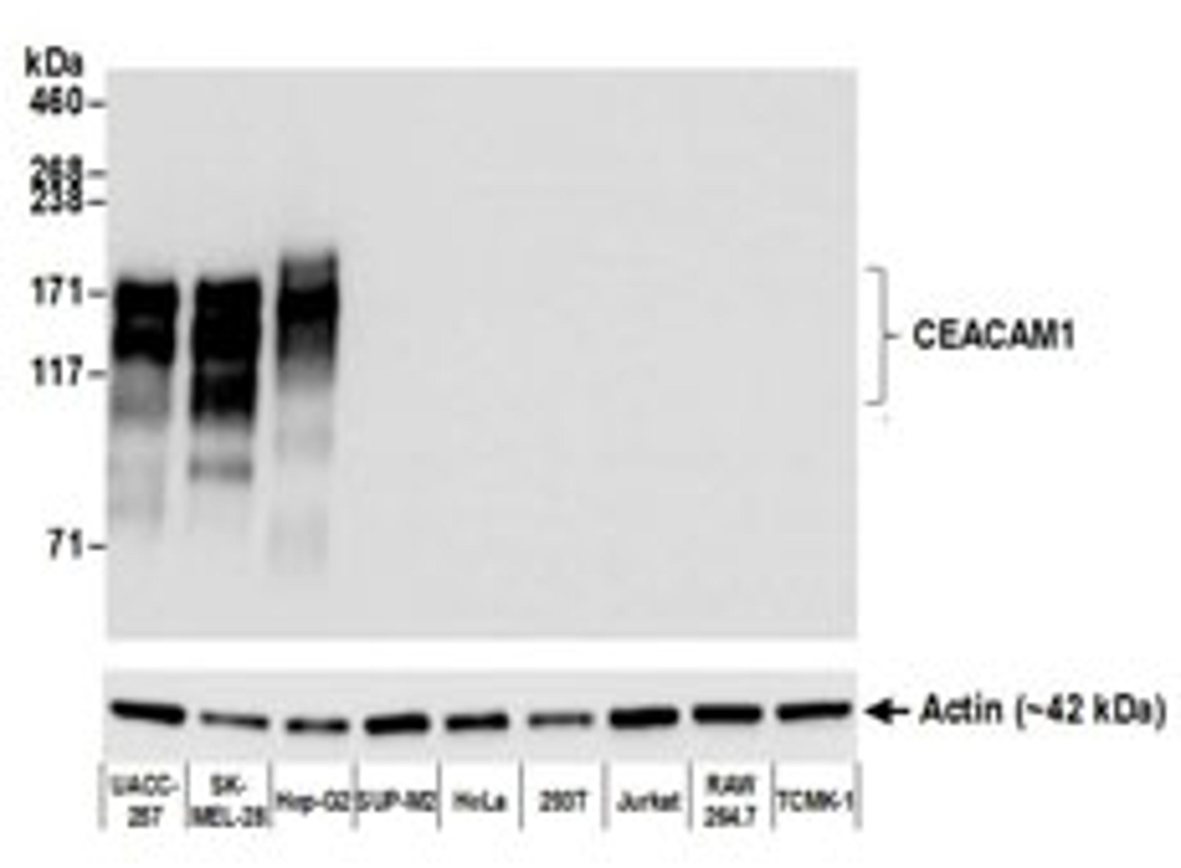 Detection of human CEACAM1/5 by western blot.