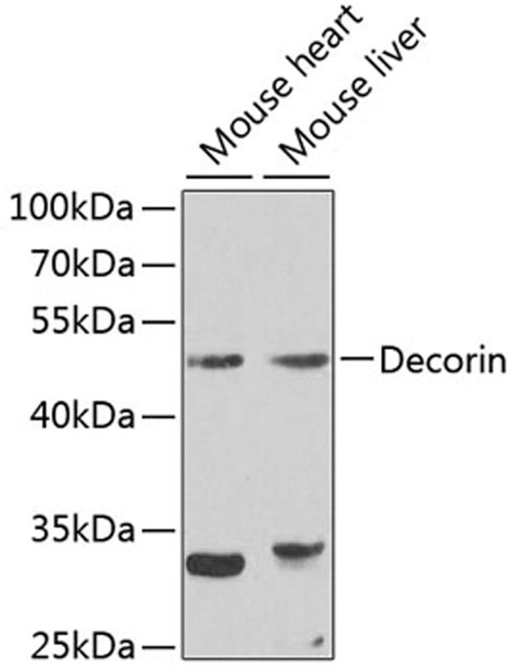 Western blot - Decorin antibody (A1669)