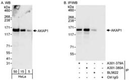 Detection of human AKAP1 by western blot and immunoprecipitation.