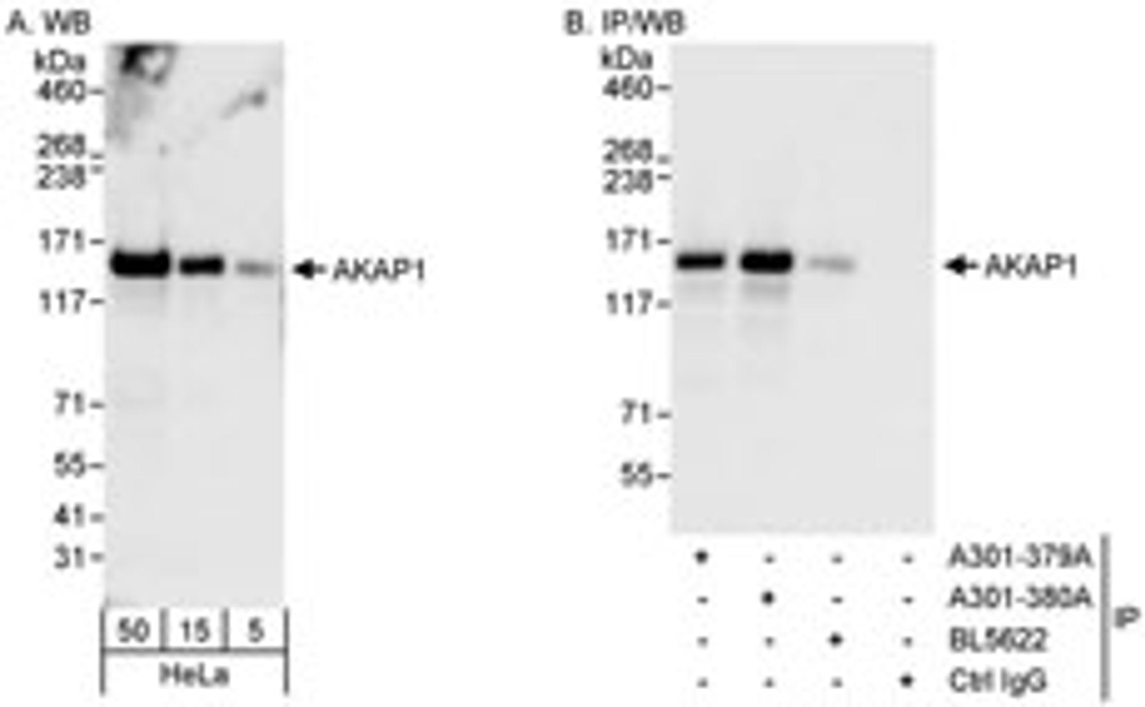 Detection of human AKAP1 by western blot and immunoprecipitation.