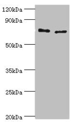 Western blot. All lanes: Protein-glutamine gamma-glutamyltransferase 2 antibody at 8ug/ml. Lane 1: Hela whole cell lysate. Lane 2: HepG2 whole cell lysate. Secondary. Goat polyclonal to rabbit IgG at 1/10000 dilution. Predicted band size: 78, 62, 39 kDa. Observed band size: 78 kDa.