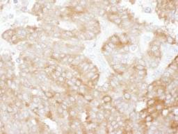 Detection of human NHERF1 by immunohistochemistry.