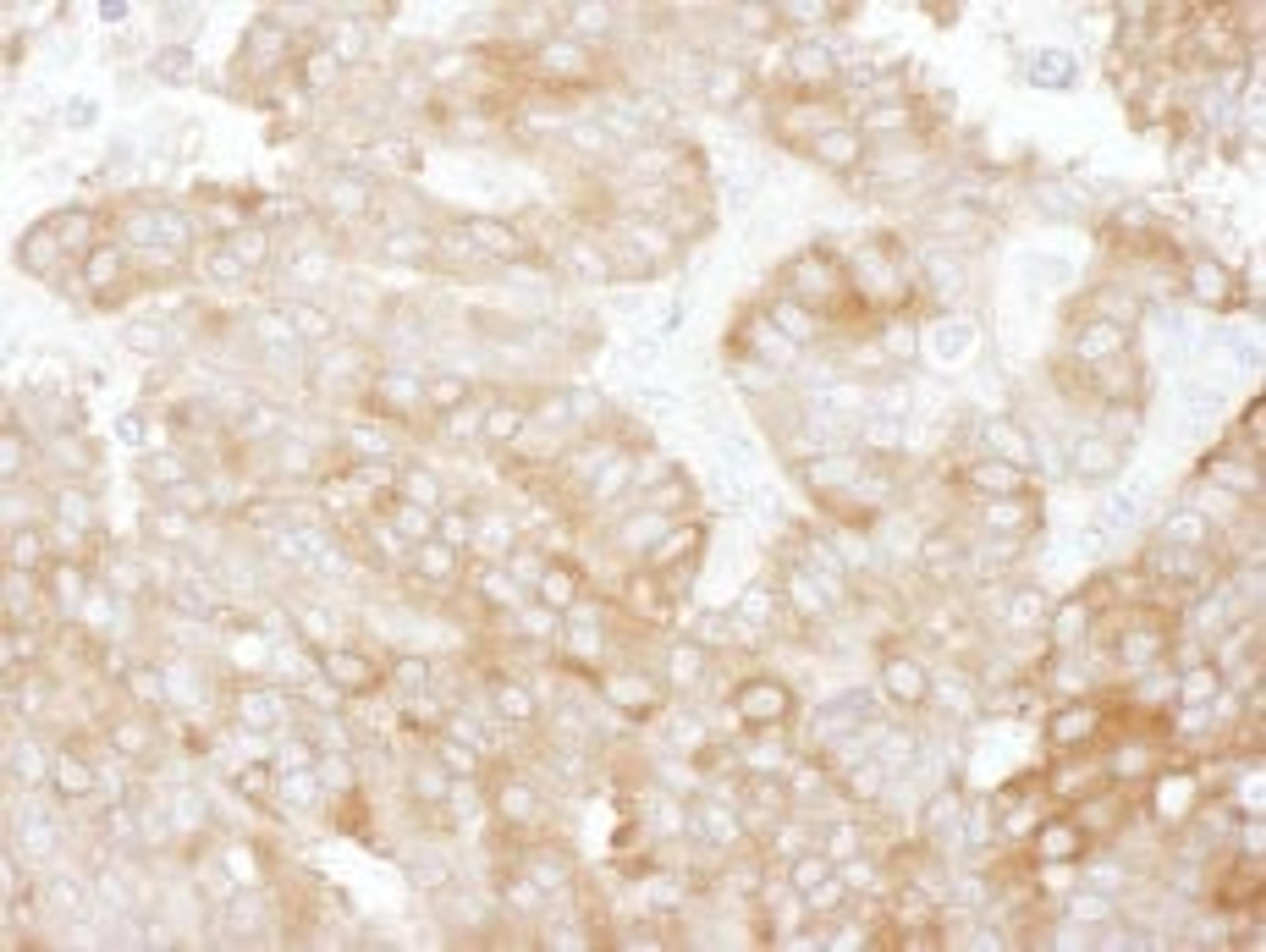 Detection of human NHERF1 by immunohistochemistry.