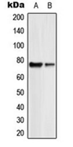 Western blot analysis of HL60 (Lane 1), Jurkat (Lane 2) whole cell lysates using GUCY1B2 antibody