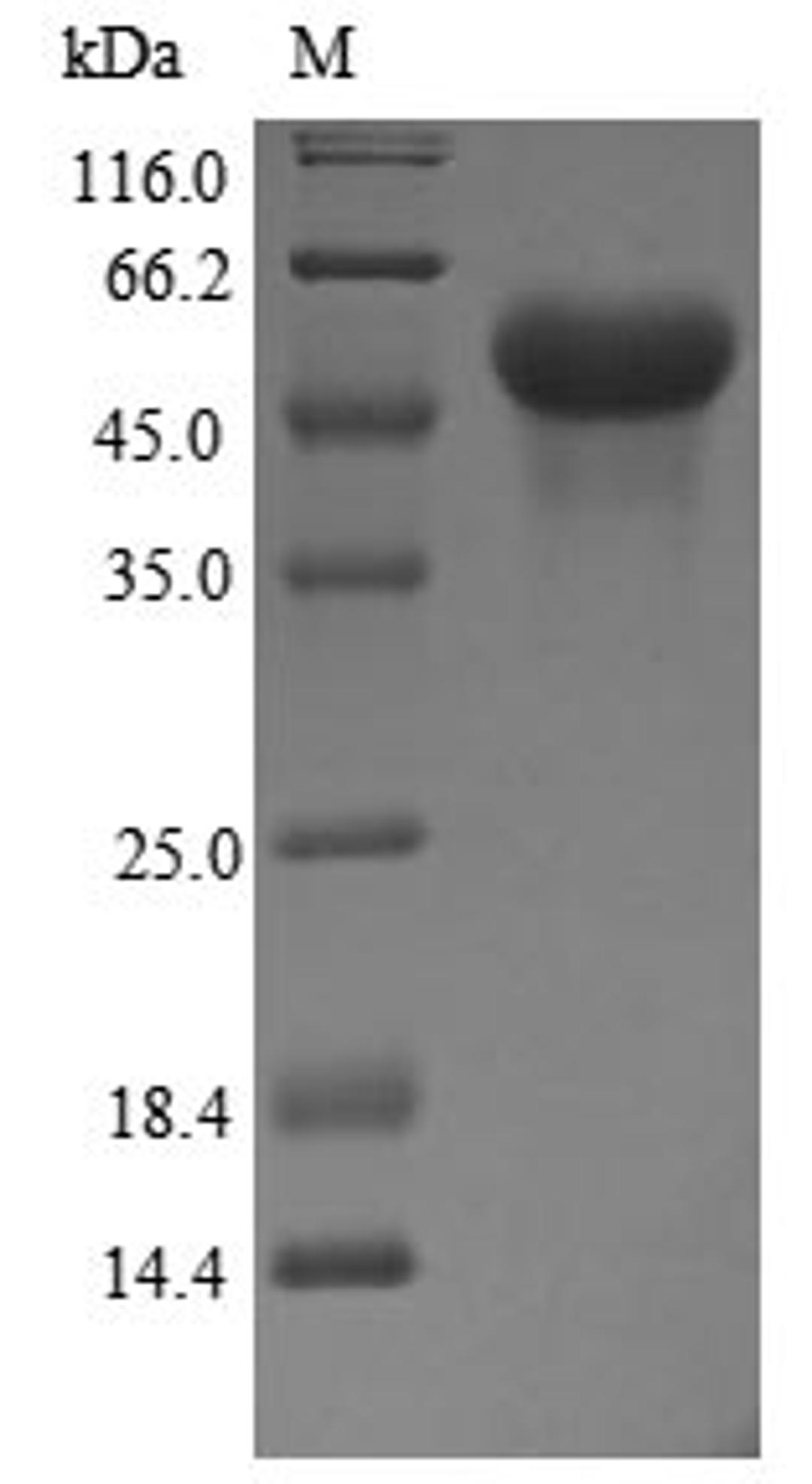 (Tris-Glycine gel) Discontinuous SDS-PAGE (reduced) with 5% enrichment gel and 15% separation gel.