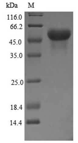 (Tris-Glycine gel) Discontinuous SDS-PAGE (reduced) with 5% enrichment gel and 15% separation gel.