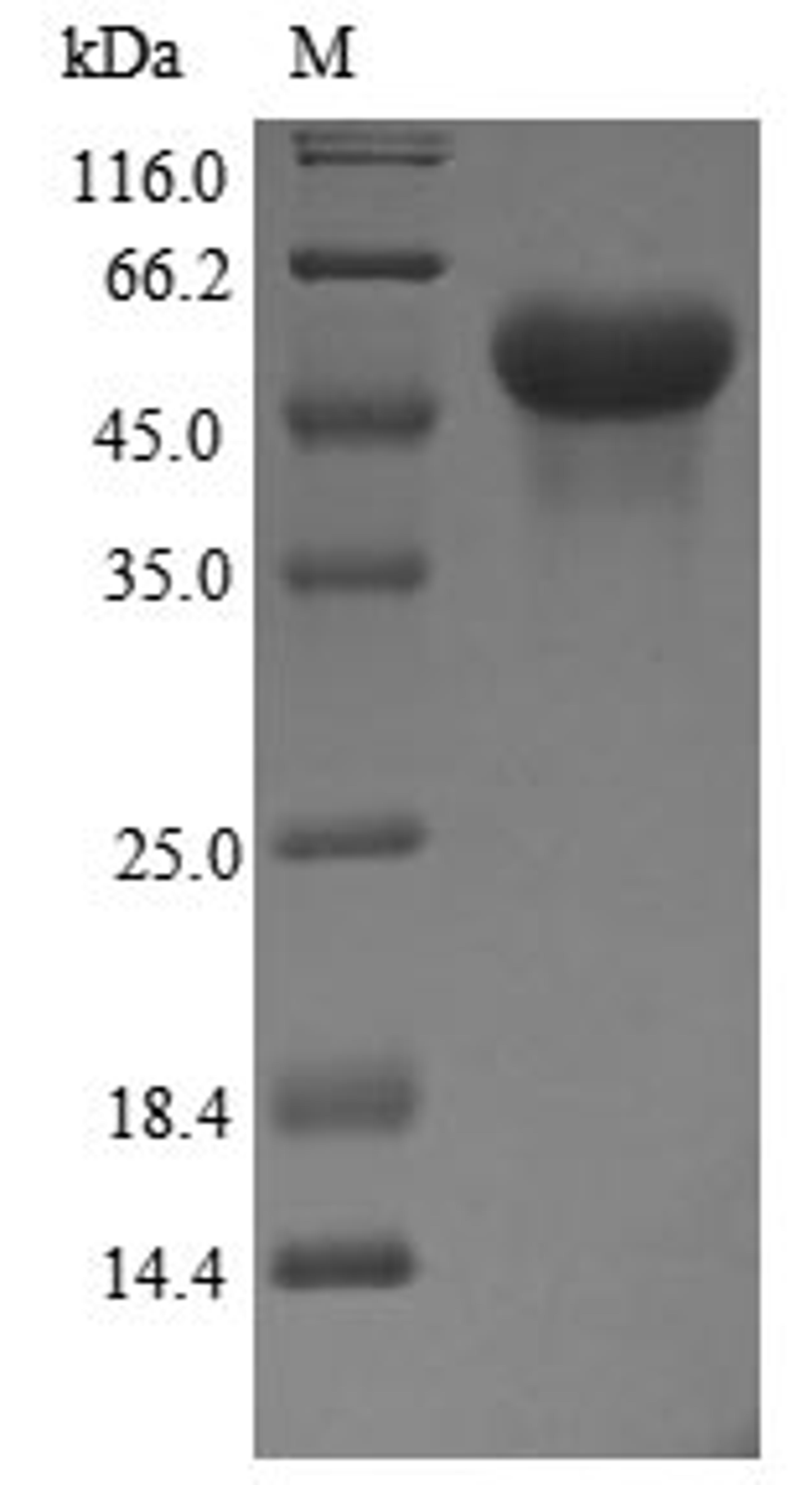 (Tris-Glycine gel) Discontinuous SDS-PAGE (reduced) with 5% enrichment gel and 15% separation gel.
