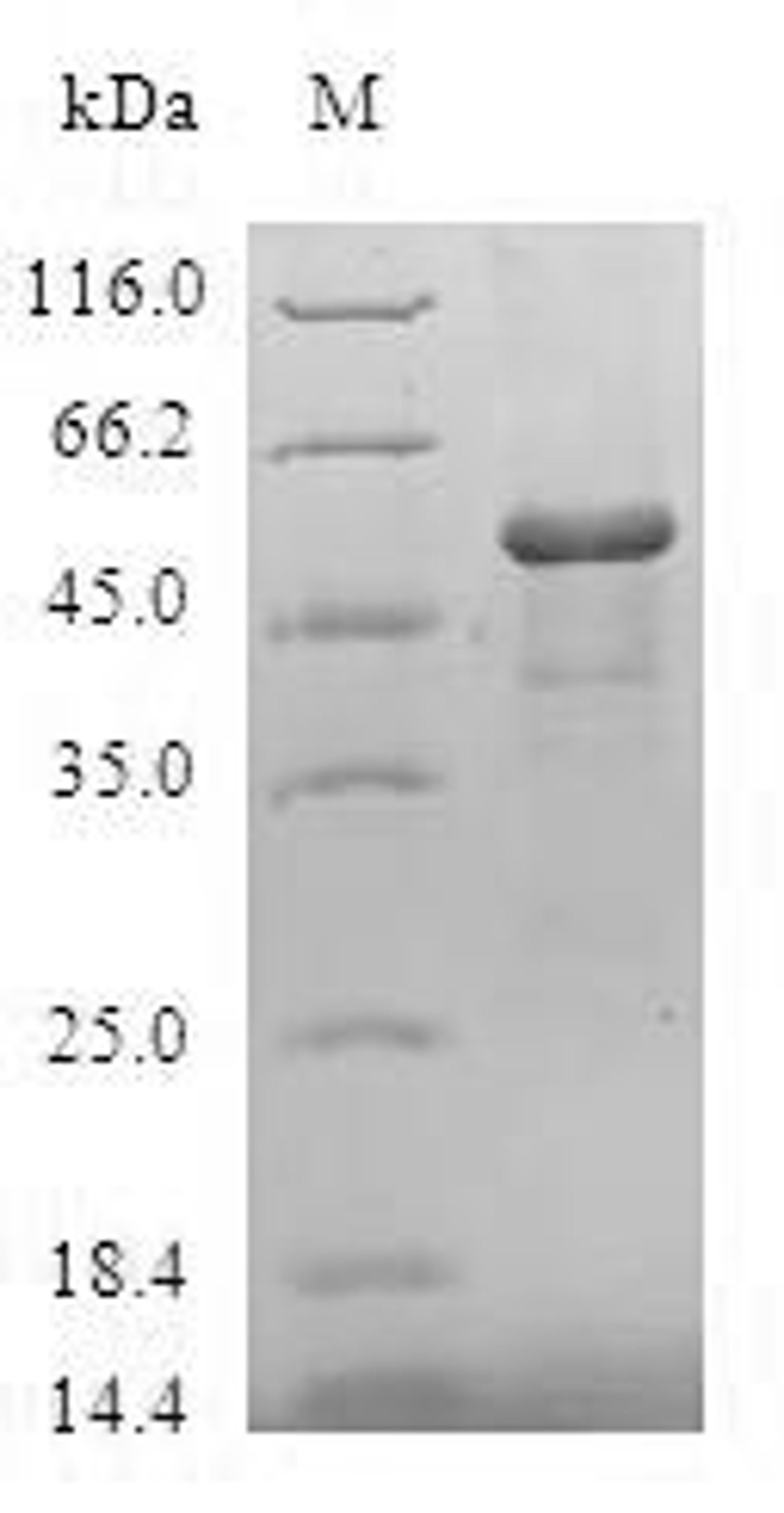 (Tris-Glycine gel) Discontinuous SDS-PAGE (reduced) with 5% enrichment gel and 15% separation gel.