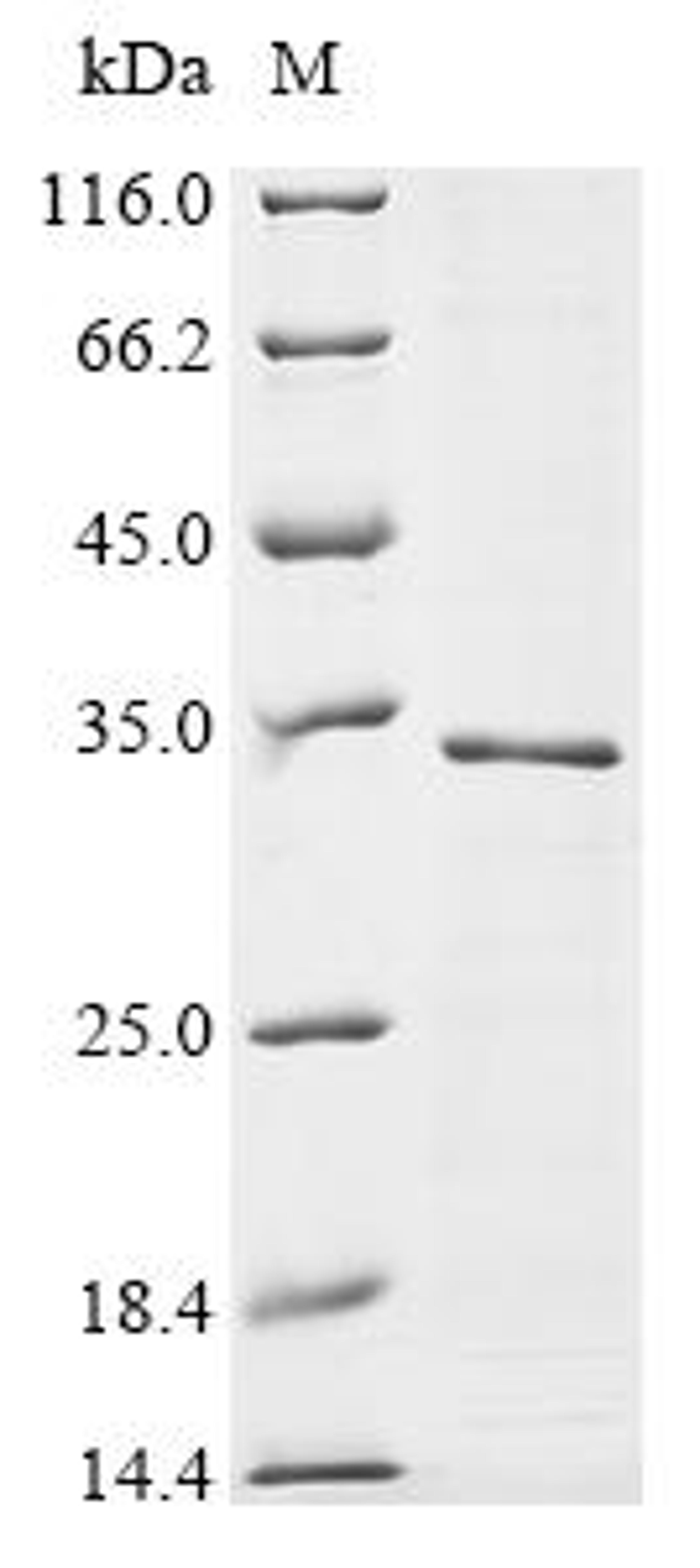 (Tris-Glycine gel) Discontinuous SDS-PAGE (reduced) with 5% enrichment gel and 15% separation gel.