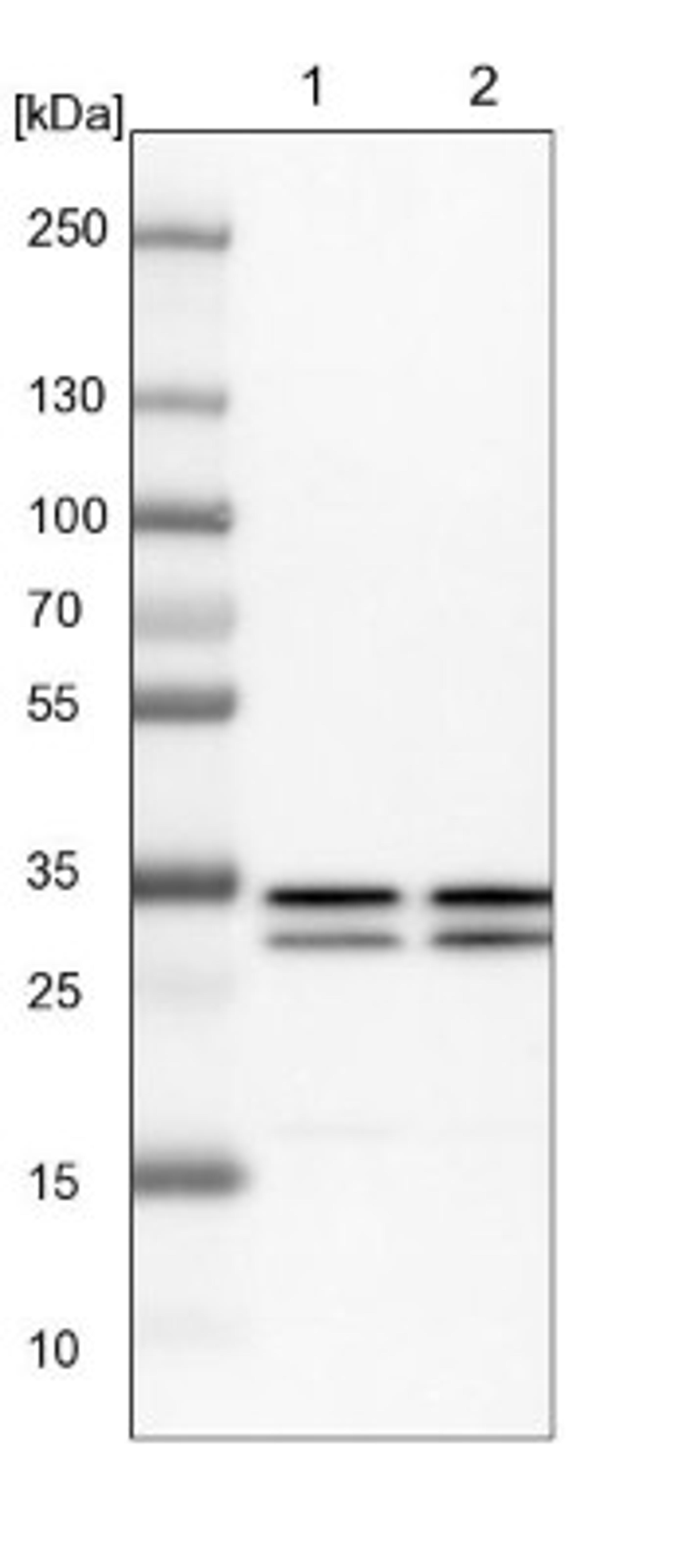 Western Blot: TFIIE beta Antibody [NBP1-87931] - Lane 1: NIH-3T3 cell lysate (Mouse embryonic fibroblast cells)<br/>Lane 2: NBT-II cell lysate (Rat Wistar bladder tumour cells)