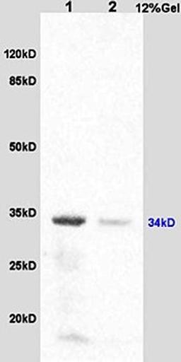 Western blot analysis of mouse testis lysates(Lane1, 30ug) and mouse brain lysates(Lane2, 30ug) using HSD17B3 antibody at 1:200