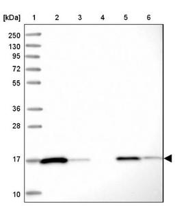 Western Blot: Peroxiredoxin 5 Antibody [NBP2-38370] - Lane 1: Marker [kDa] 250, 130, 95, 72, 55, 36, 28, 17, 10<br/>Lane 2: RT-4<br/>Lane 3: U-251 MG<br/>Lane 4: Human Plasma<br/>Lane 5: Liver<br/>Lane 6: Tonsil