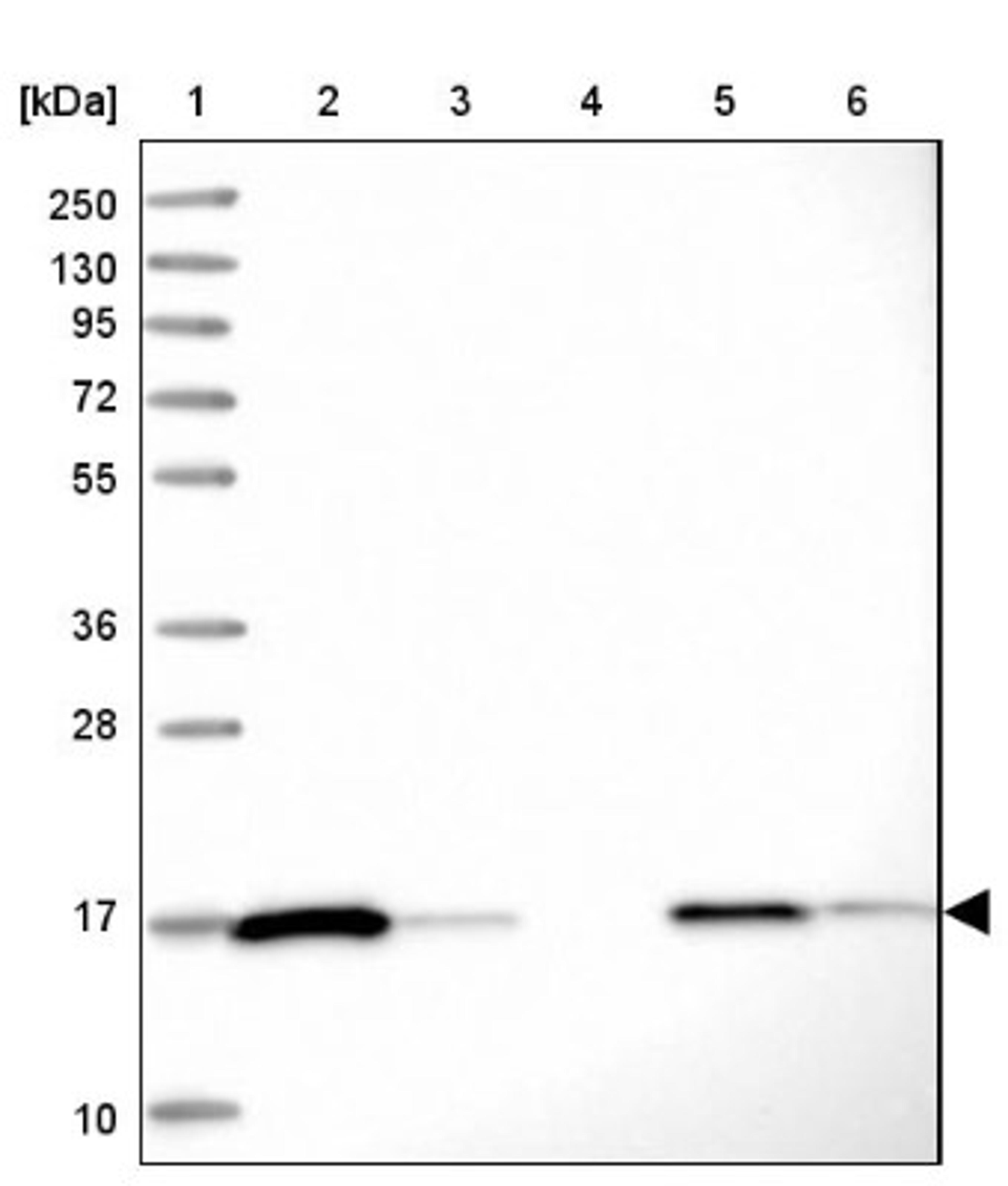 Western Blot: Peroxiredoxin 5 Antibody [NBP2-38370] - Lane 1: Marker [kDa] 250, 130, 95, 72, 55, 36, 28, 17, 10<br/>Lane 2: RT-4<br/>Lane 3: U-251 MG<br/>Lane 4: Human Plasma<br/>Lane 5: Liver<br/>Lane 6: Tonsil