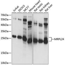 Western blot - MRPL24 antibody (A4967)