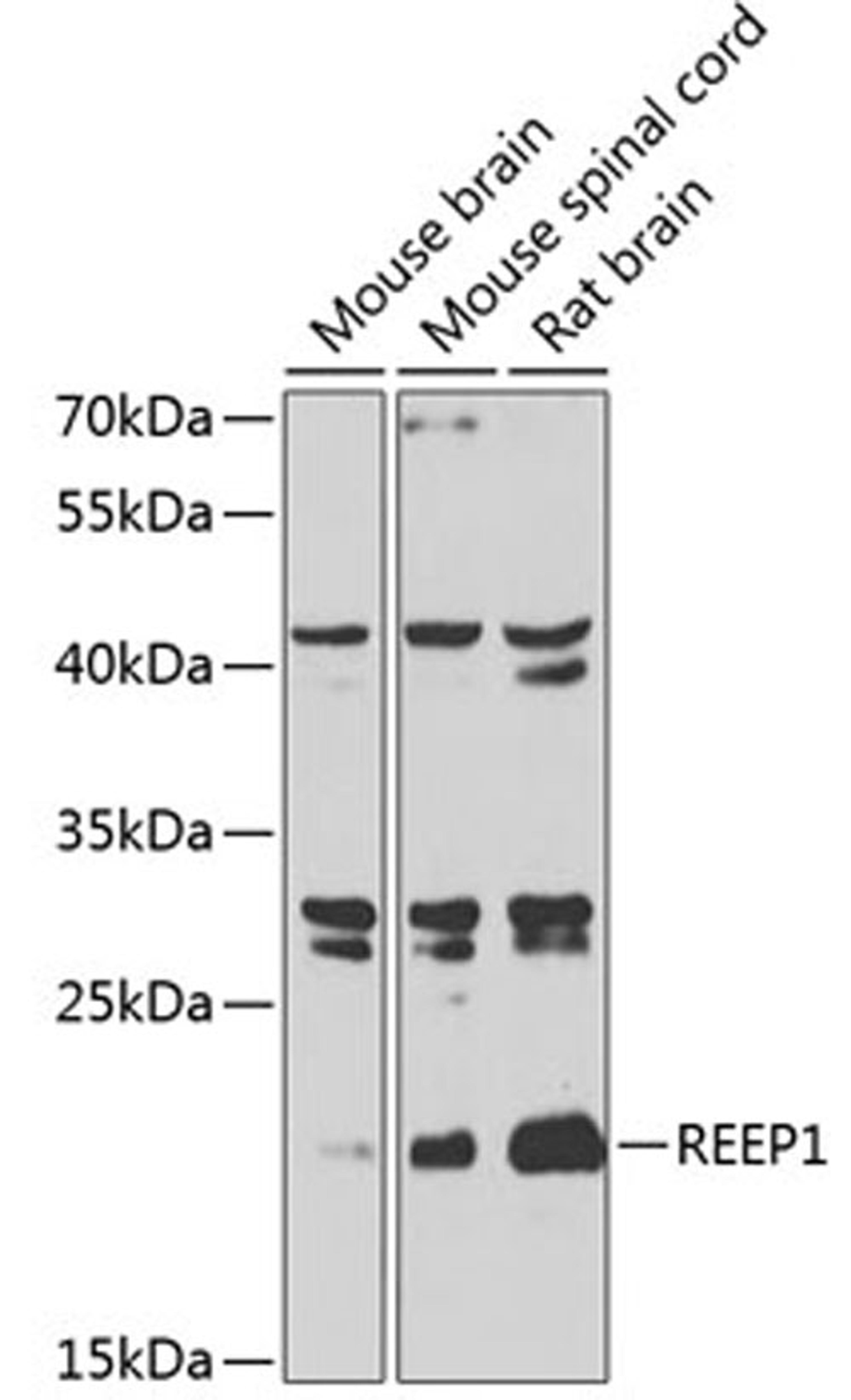 Western blot - REEP1 antibody (A7832)