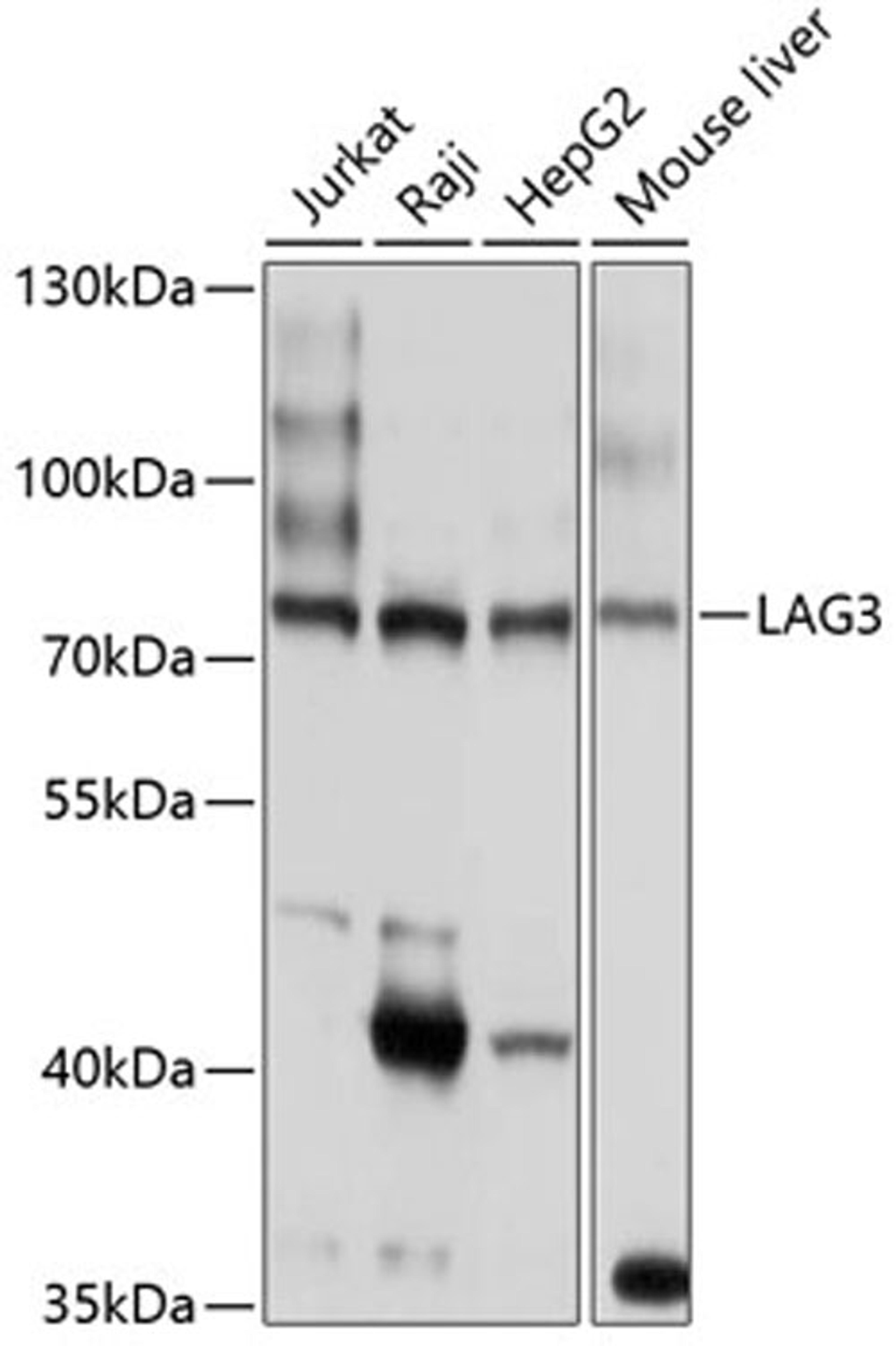 Western blot - LAG3 antibody (A2996)