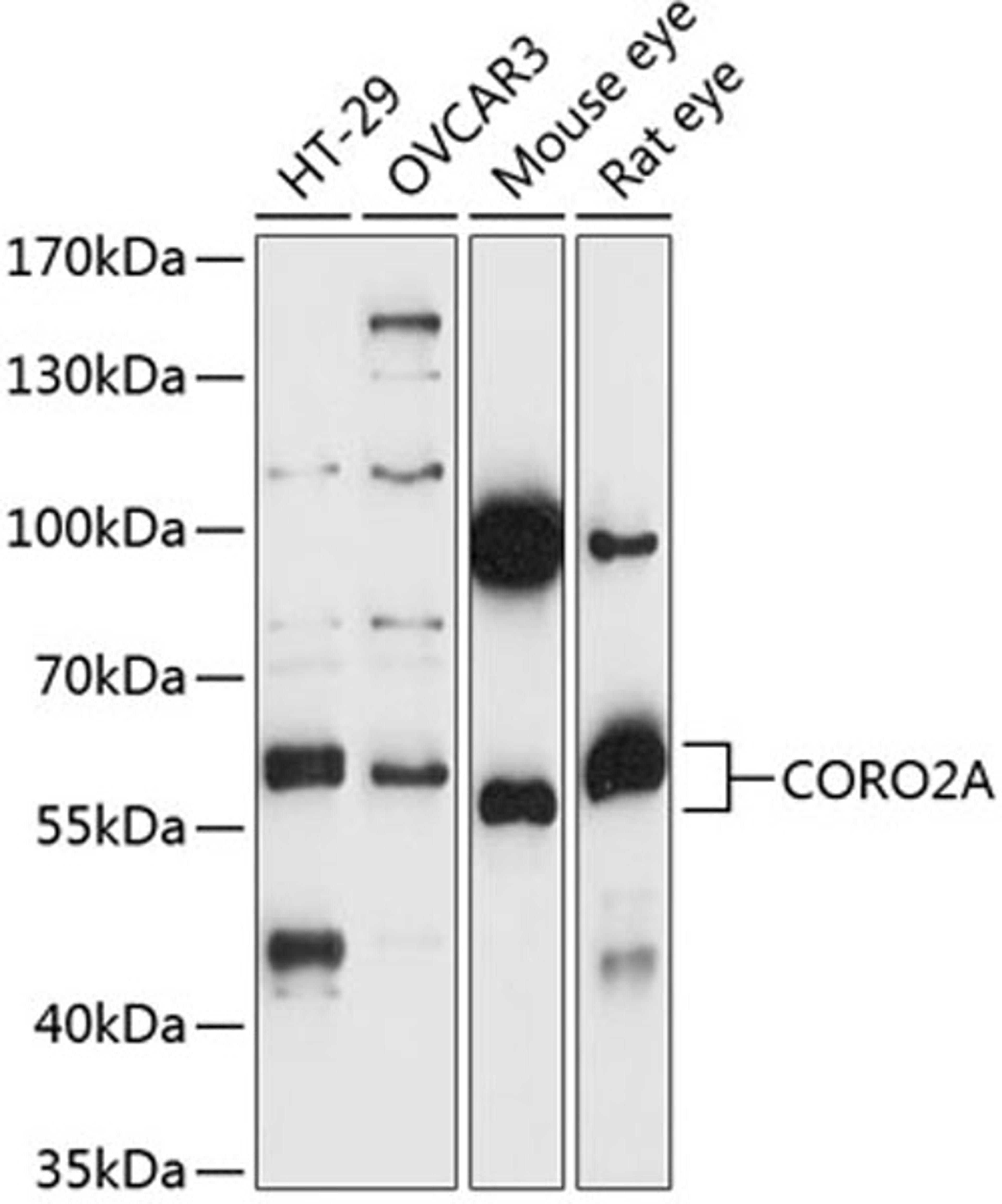 Western blot - CORO2A antibody (A14469)