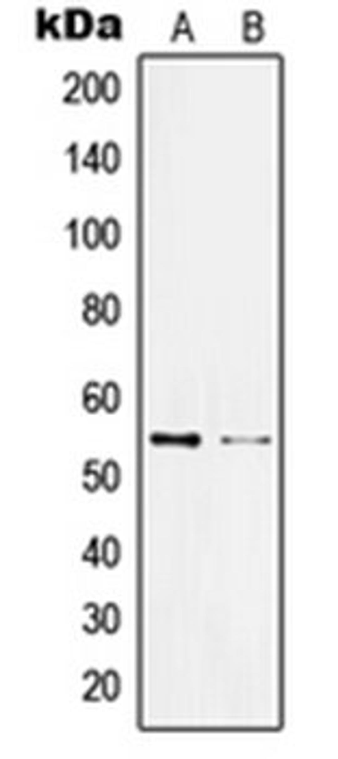 Western blot analysis of Jurkat (Lane 1), HL60 (Lane 2) whole cell lysates using KLF11 antibody