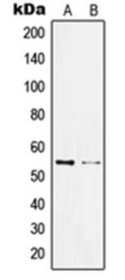 Western blot analysis of Jurkat (Lane 1), HL60 (Lane 2) whole cell lysates using KLF11 antibody