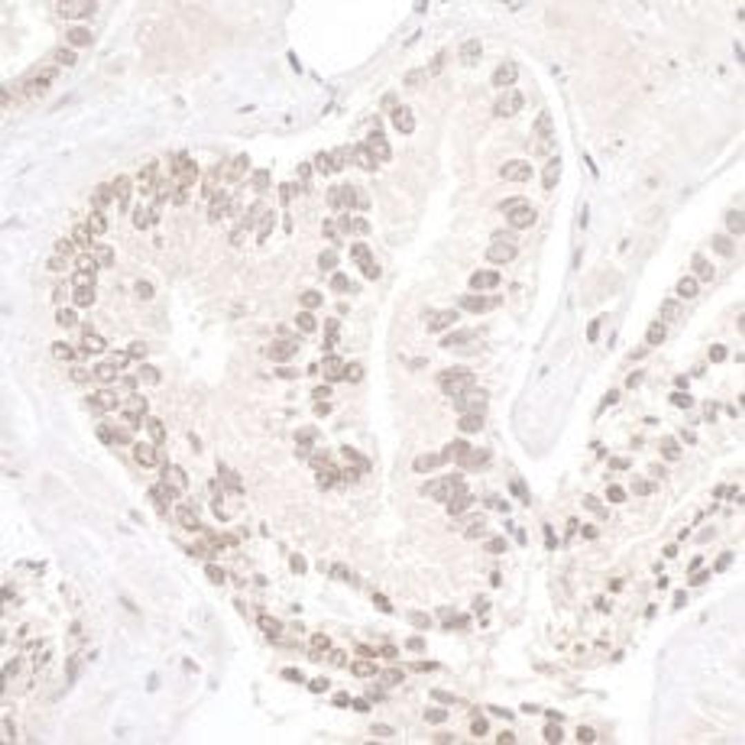 Detection of human NP95/UHRF1 by immunohistochemistry.