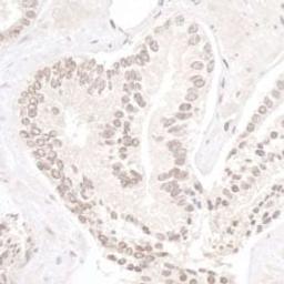 Detection of human NP95/UHRF1 by immunohistochemistry.