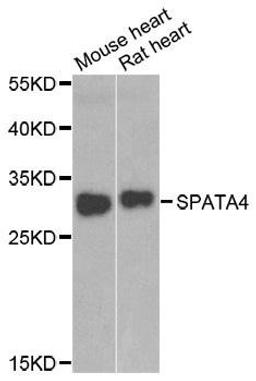 Western blot analysis of extracts of various cell lines using SPATA4 antibody