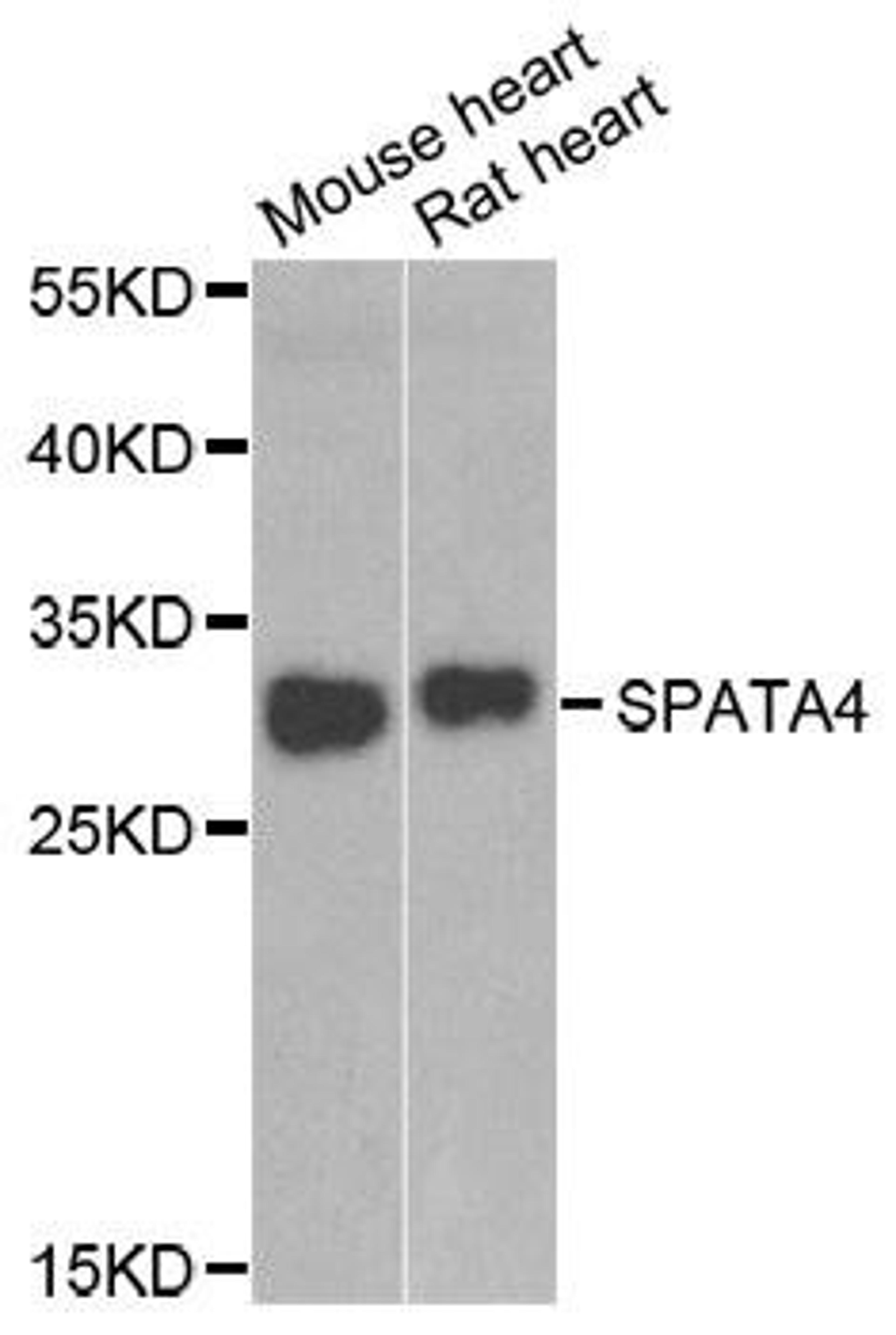 Western blot analysis of extracts of various cell lines using SPATA4 antibody