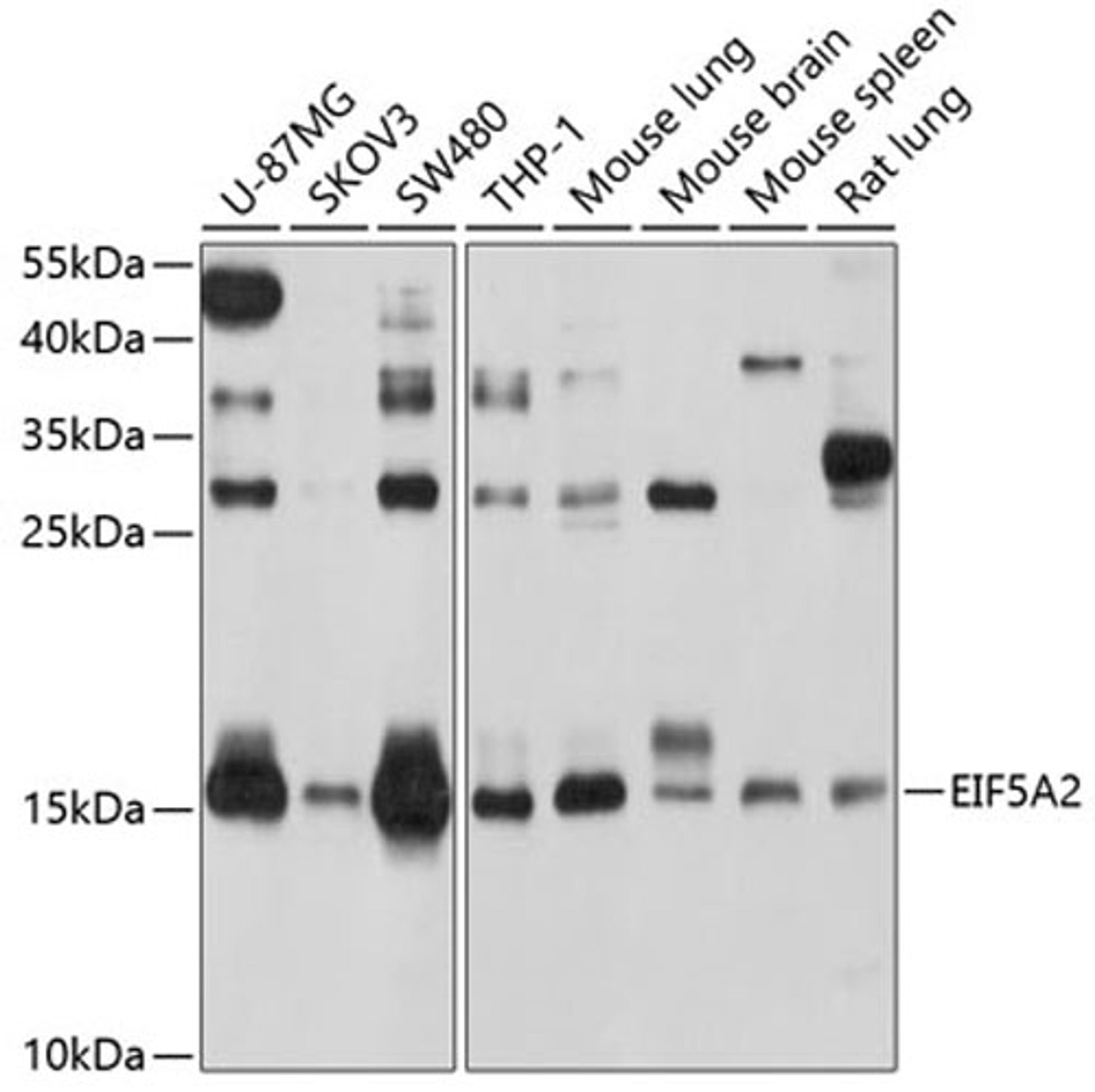 Western blot - EIF5A2 antibody (A4864)