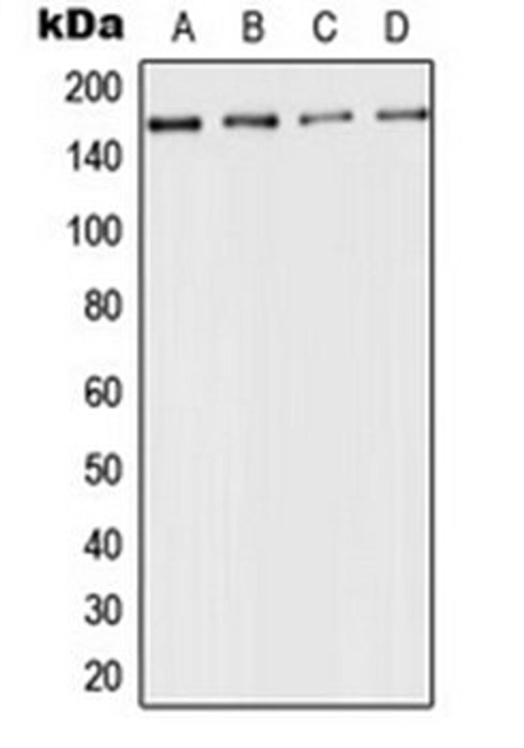 Western blot analysis of HeLa (Lane 1), mouse kidney (Lane 2), rat liver (Lane 3), PC12 (Lane 4) whole cell lysates using ACE antibody