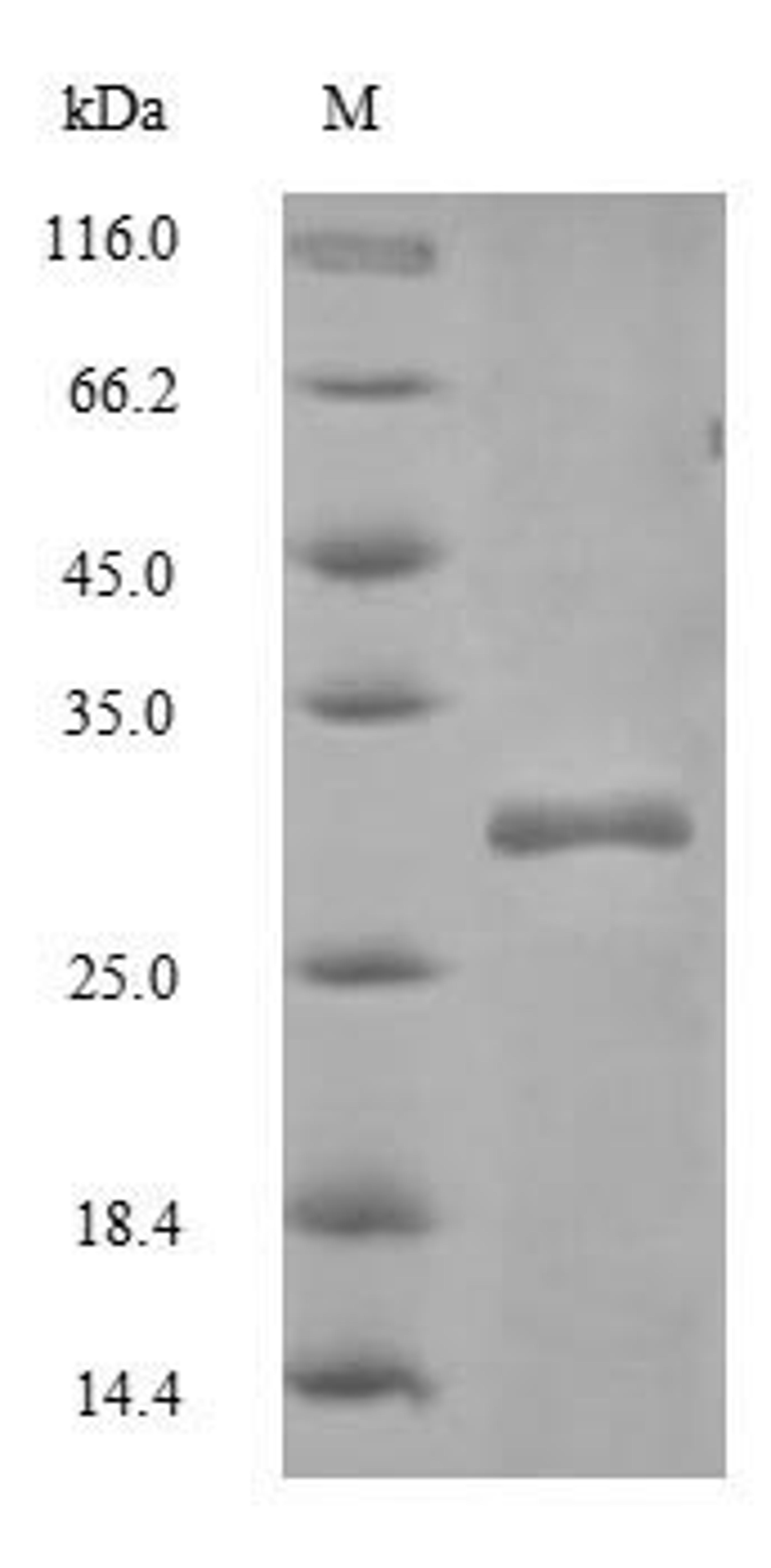 (Tris-Glycine gel) Discontinuous SDS-PAGE (reduced) with 5% enrichment gel and 15% separation gel.