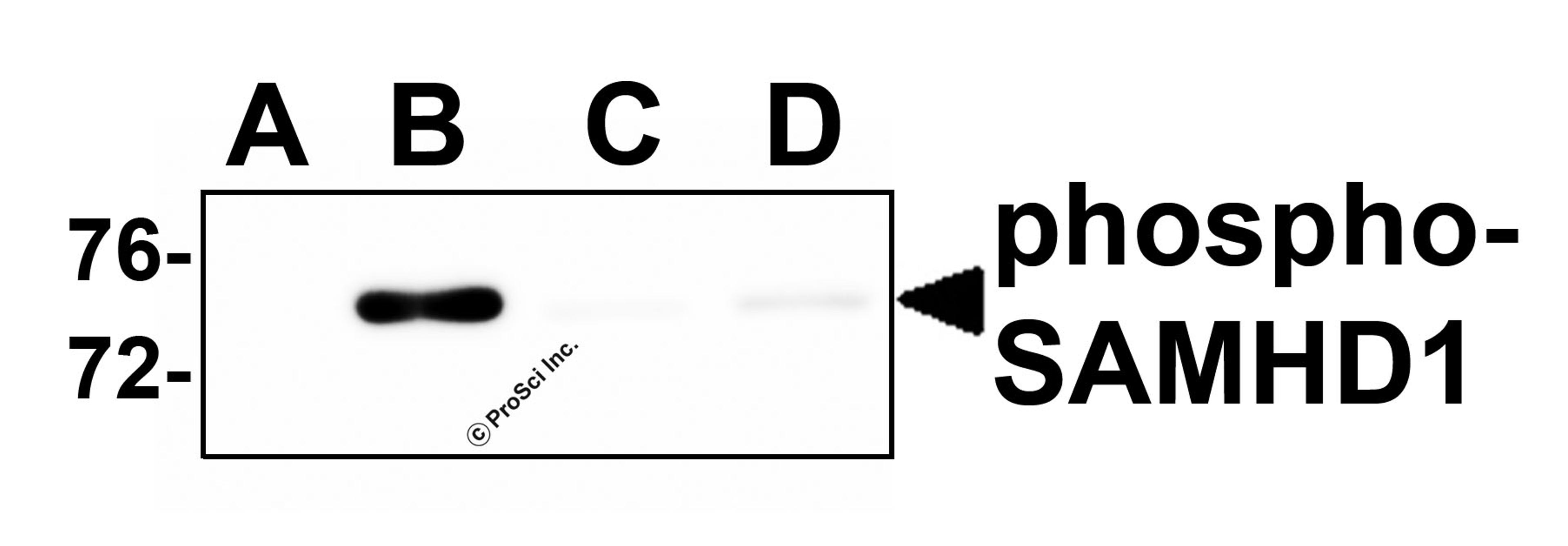 Western blot analysis of SAMHD1 (phospho Thr592) in 293 cells transfected with (A) empty expression vector, (B) wild-type SAMHD1, (C) SAMHD1 (T592A) and (D) SAMHD1 (T592E) with SAMHD1 (phospho Thr592) antibody at 1 μg/ml.