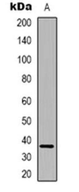 Western blot analysis of FAM84B expression in HUVEC (Lane 1) whole cell lysates using FAM84B antibody