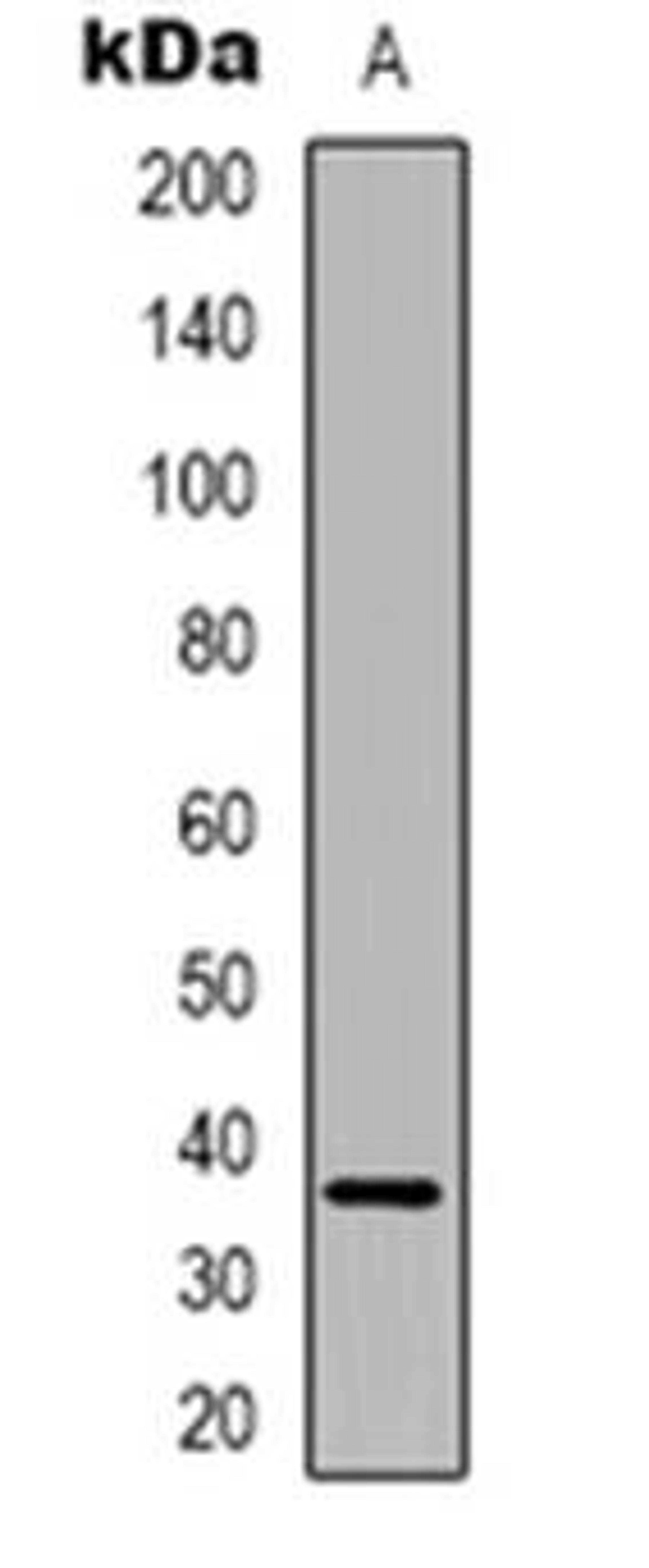 Western blot analysis of FAM84B expression in HUVEC (Lane 1) whole cell lysates using FAM84B antibody