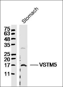 Western blot analysis of Mouse Stomach Lysate using VSTM5 antibody.