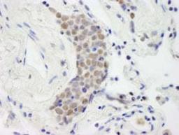 Detection of human Topo II Beta by immunohistochemistry.