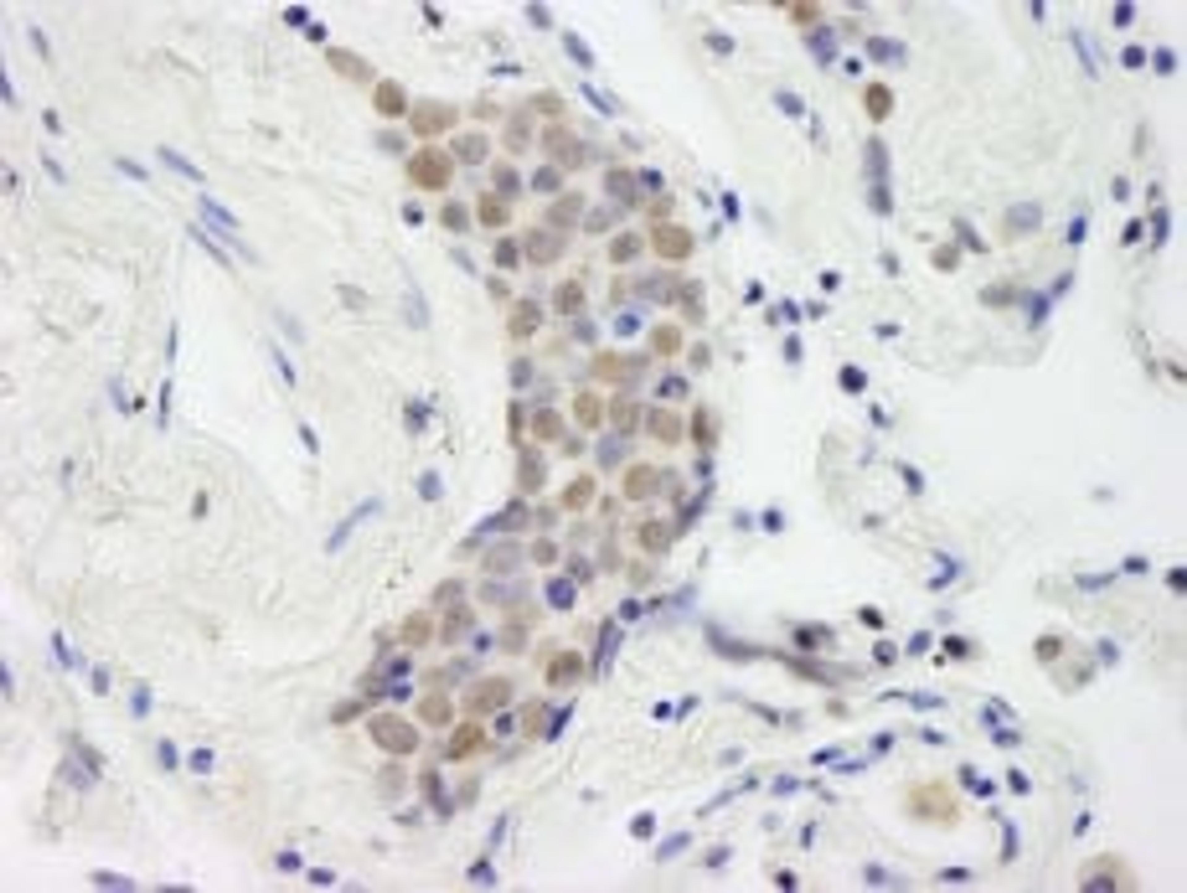 Detection of human Topo II Beta by immunohistochemistry.