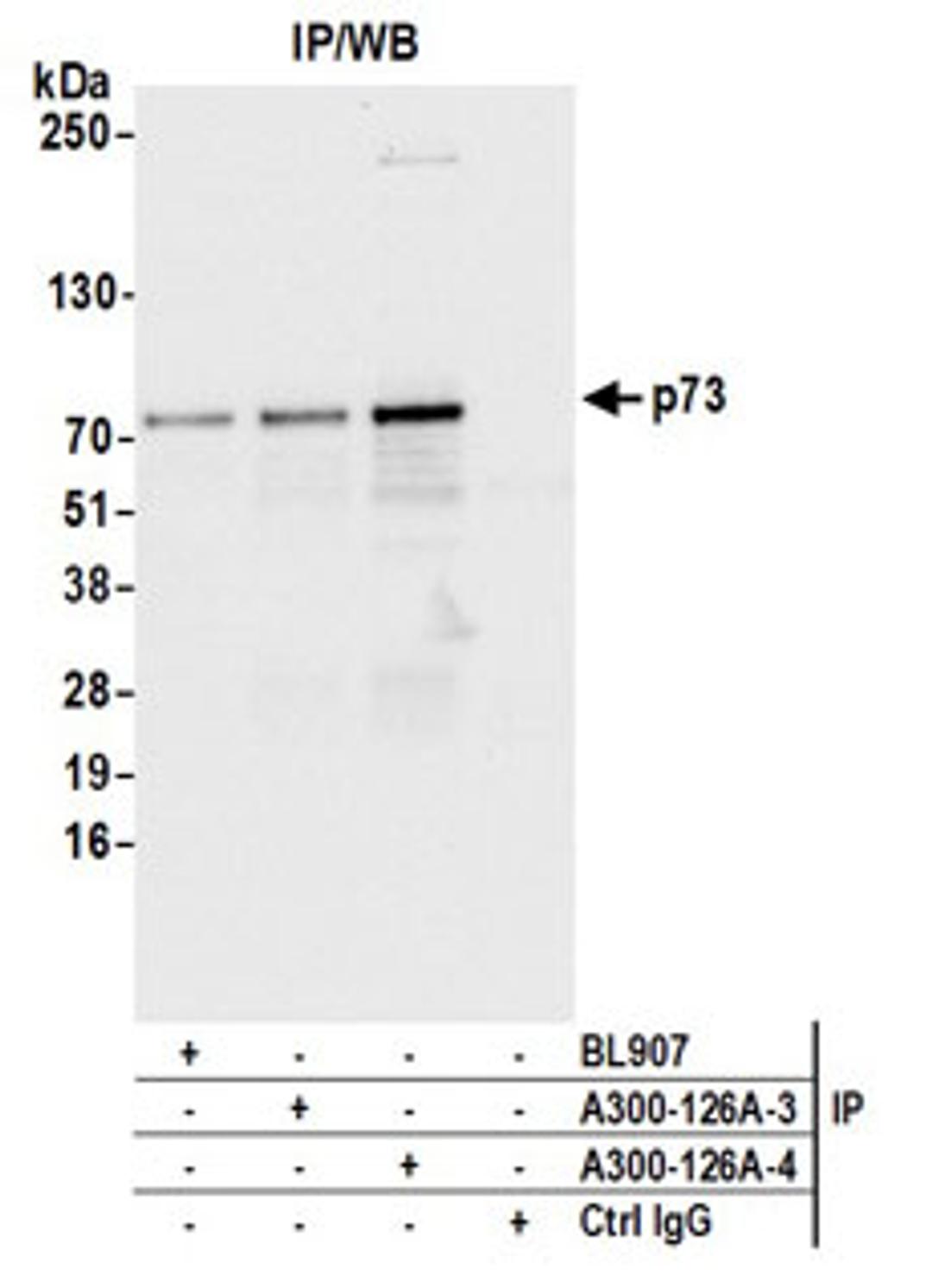 Detection of human p73 by western blot of immunoprecipitates.