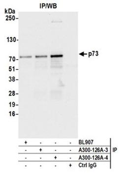 Detection of human p73 by western blot of immunoprecipitates.