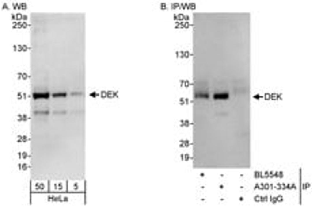 Detection of human DEK by western blot and immunoprecipitation.