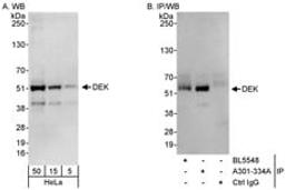 Detection of human DEK by western blot and immunoprecipitation.