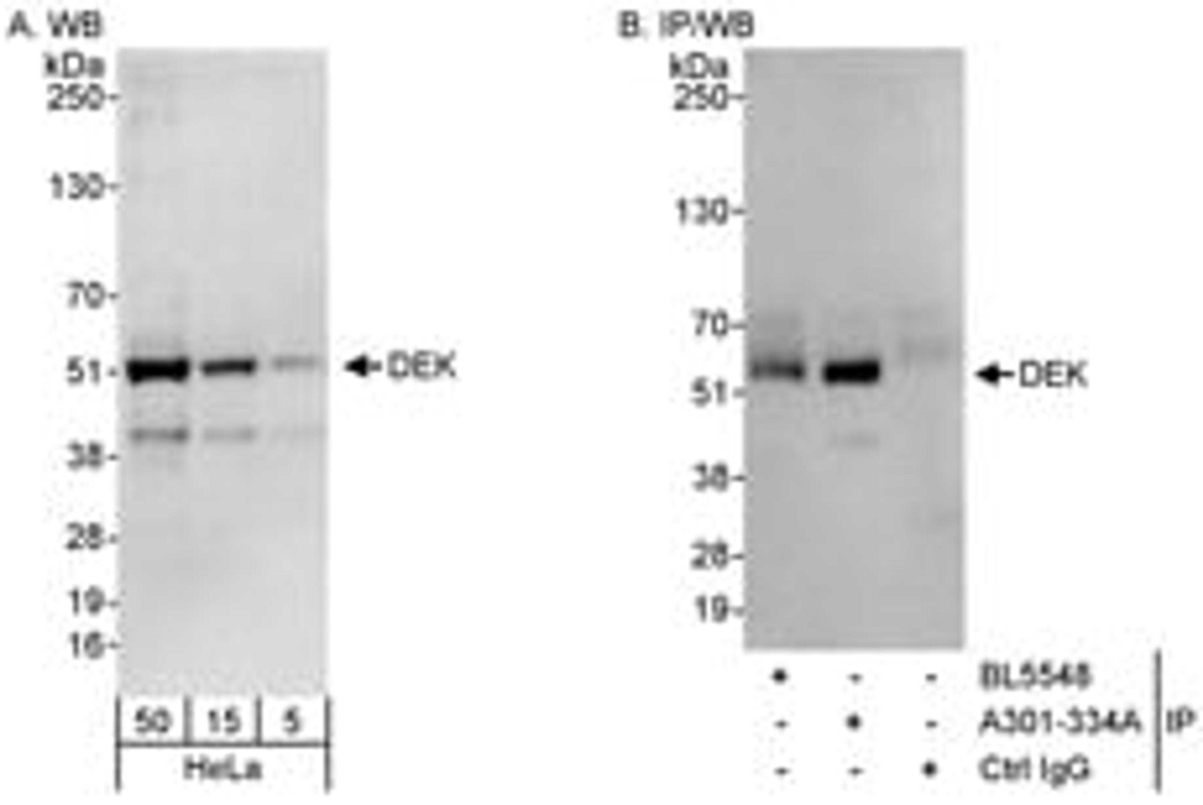 Detection of human DEK by western blot and immunoprecipitation.