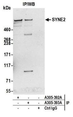 Detection of human SYNE2 by western blot of immunoprecipitates.