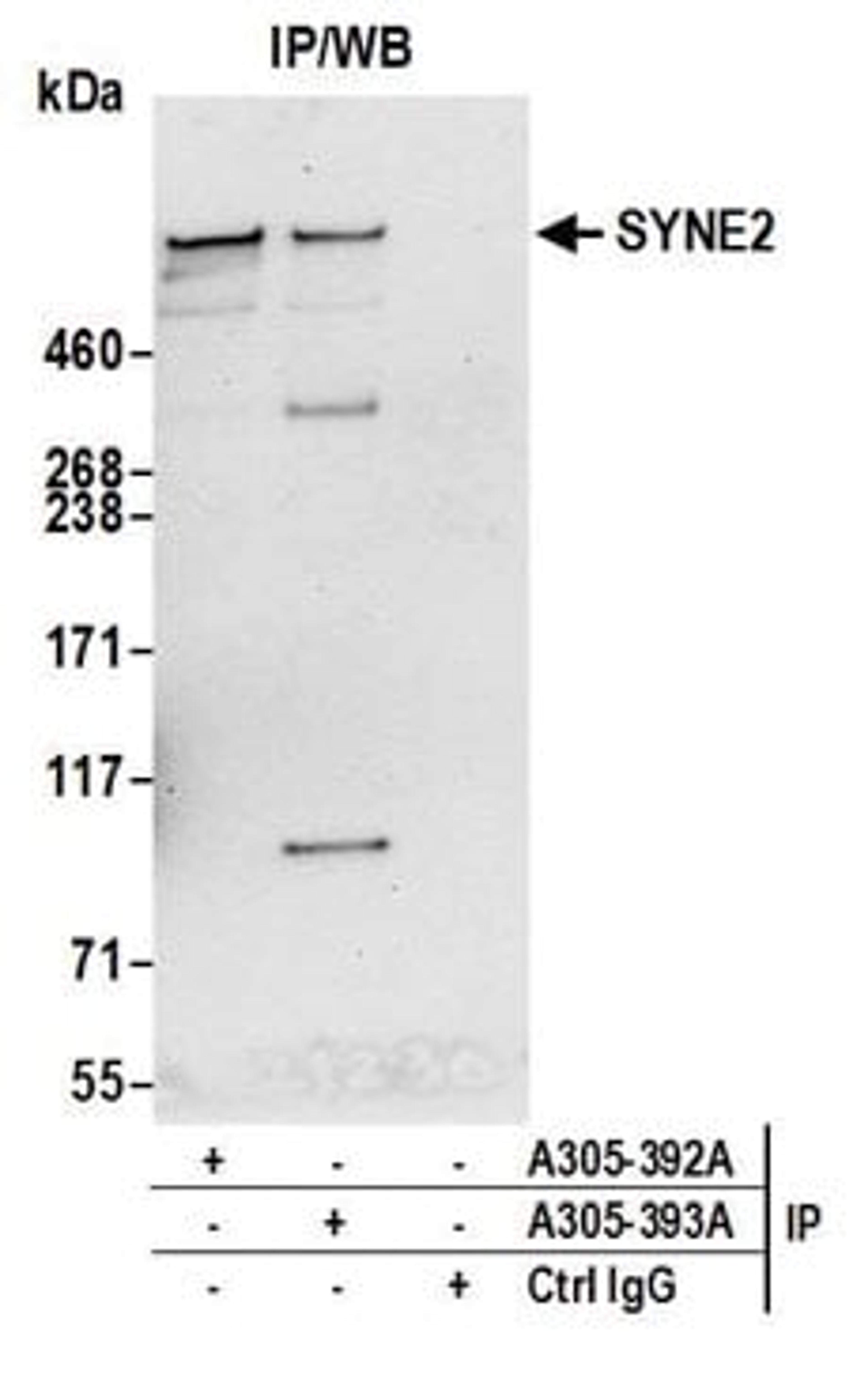 Detection of human SYNE2 by western blot of immunoprecipitates.