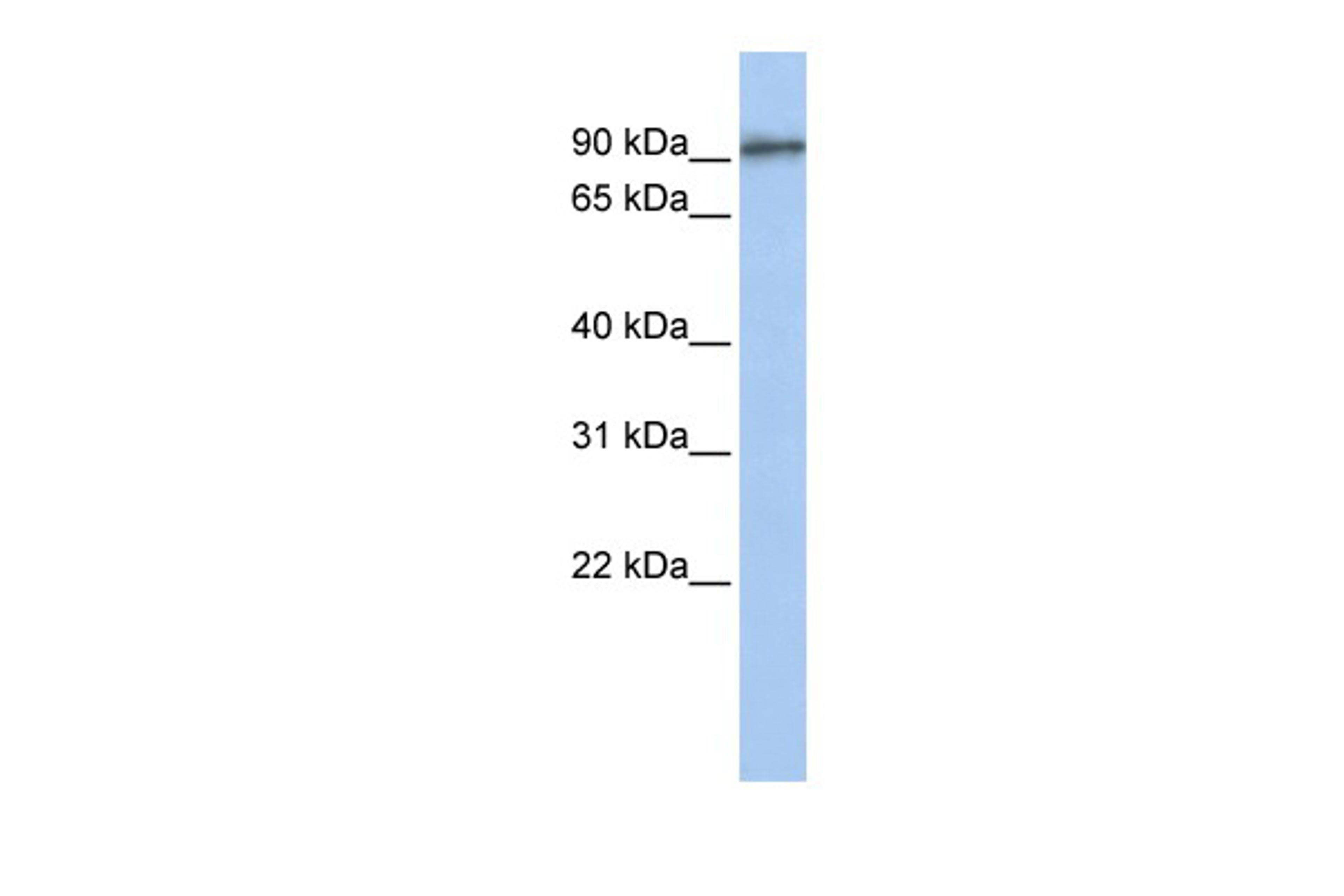 Antibody used in WB on Human MCF-7 at 0.2-1 ug/ml.