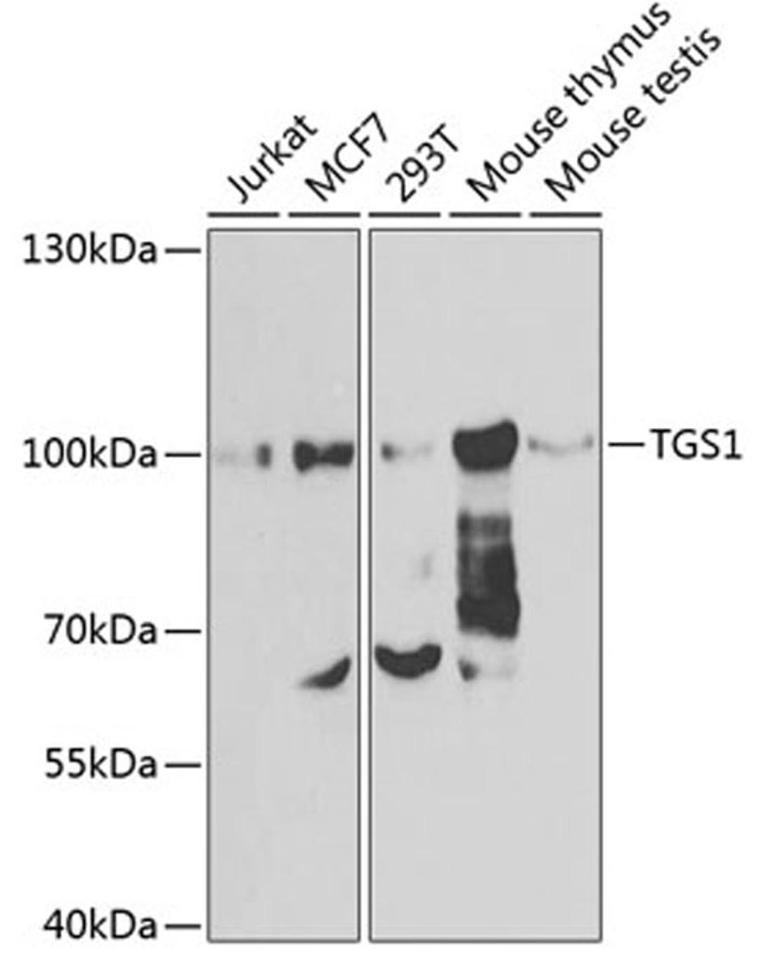 Western blot - TGS1 antibody (A7848)