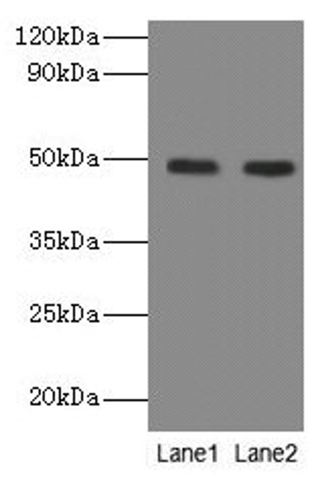 Western blot. All lanes: NEU3 antibody at 2µg/ml. Lane 1: A549 whole cell lysate. Lane 2: U251 whole cell lysate. Secondary. Goat polyclonal to rabbit IgG at 1/10000 dilution. Predicted band size: 49, 52 kDa. Observed band size: 49 kDa