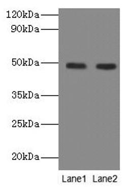 Western blot. All lanes: NEU3 antibody at 2µg/ml. Lane 1: A549 whole cell lysate. Lane 2: U251 whole cell lysate. Secondary. Goat polyclonal to rabbit IgG at 1/10000 dilution. Predicted band size: 49, 52 kDa. Observed band size: 49 kDa