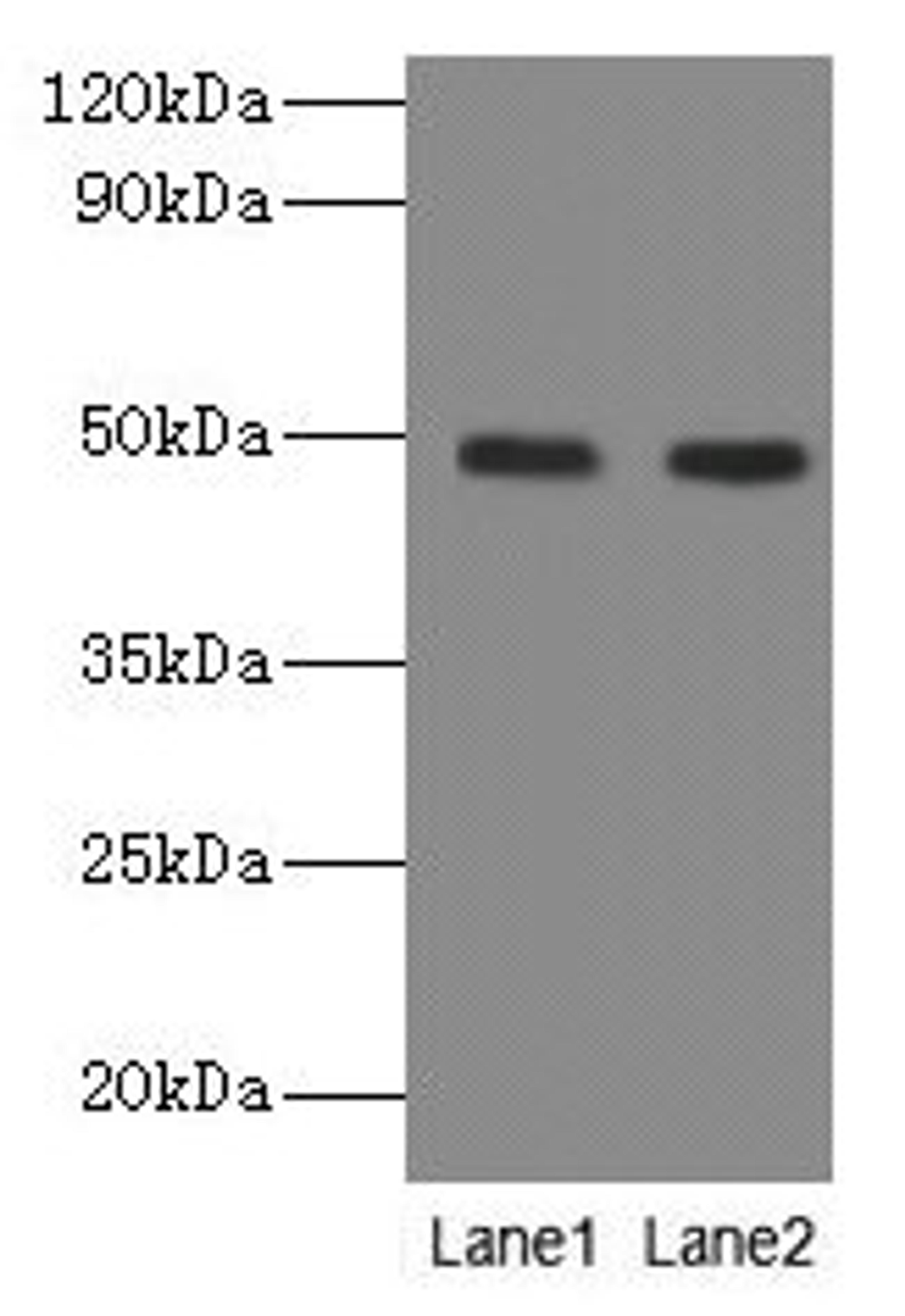 Western blot. All lanes: NEU3 antibody at 2µg/ml. Lane 1: A549 whole cell lysate. Lane 2: U251 whole cell lysate. Secondary. Goat polyclonal to rabbit IgG at 1/10000 dilution. Predicted band size: 49, 52 kDa. Observed band size: 49 kDa