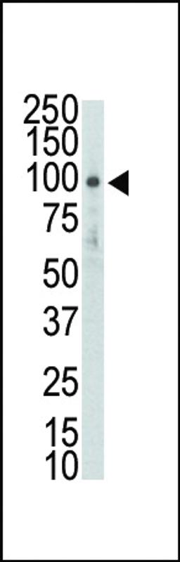 Western blot analysis of DDR2 (TYRO10) Antibodyin HL-60 lysate