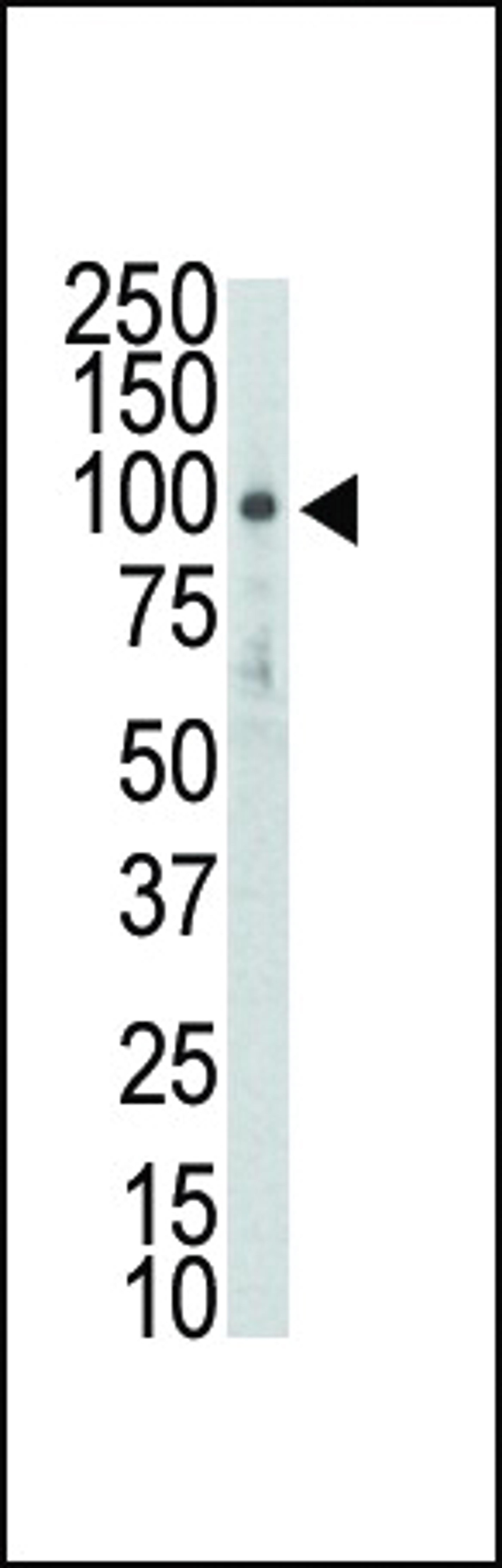 Western blot analysis of DDR2 (TYRO10) Antibodyin HL-60 lysate